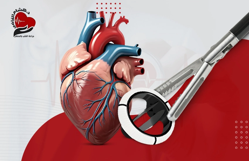 استبدال واصلاح صمامات القلب بالمنظار
