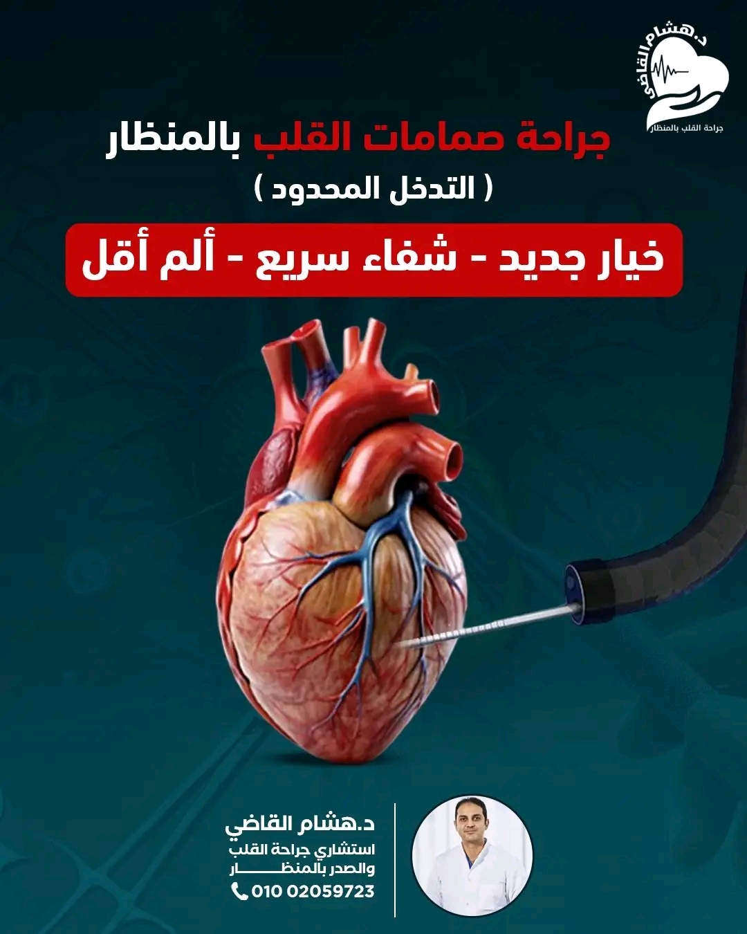 إصلاح الصمام بالمنظار