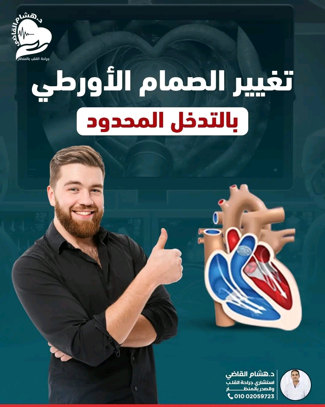 جراحة القلب بالمنظار