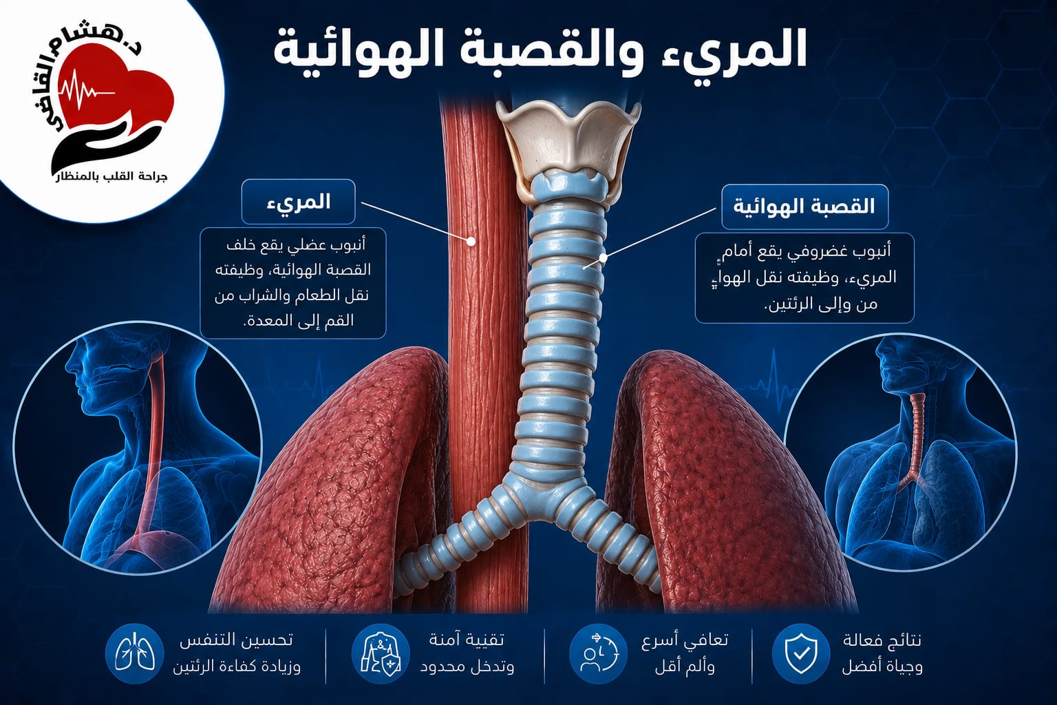 جراحة المريء والقصبة الهوائية بالمنظار