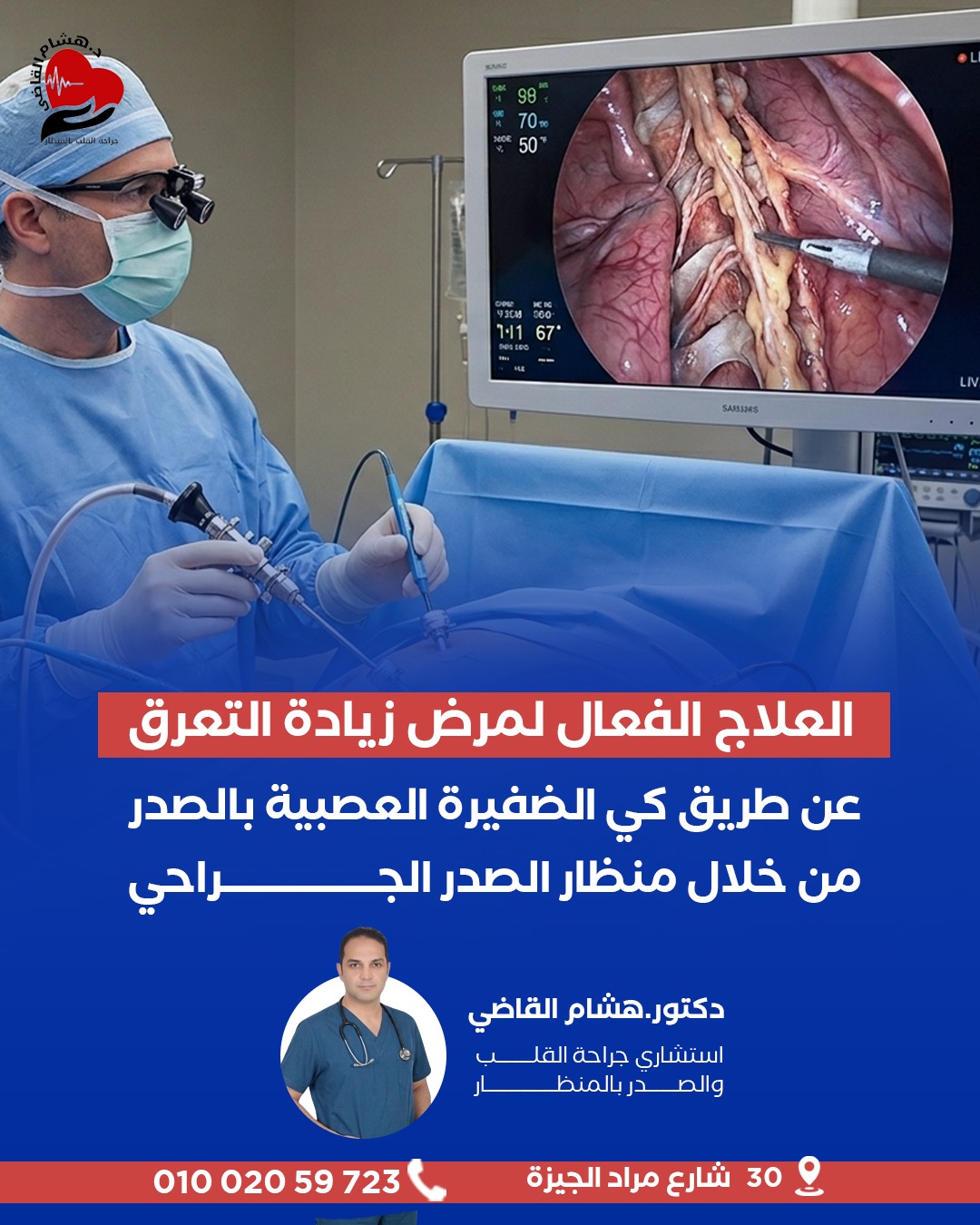 علاج التعرق الزائد