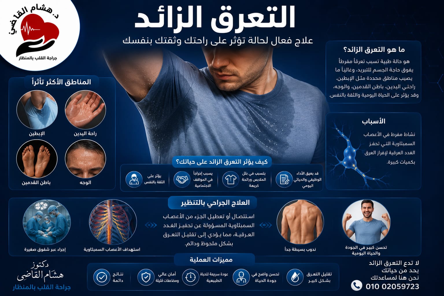 جراحة قطع العصب السمبثاوي